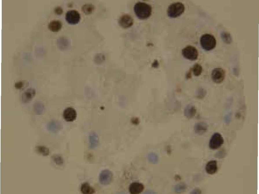 Cells are positive for cell proliferation marker KI67