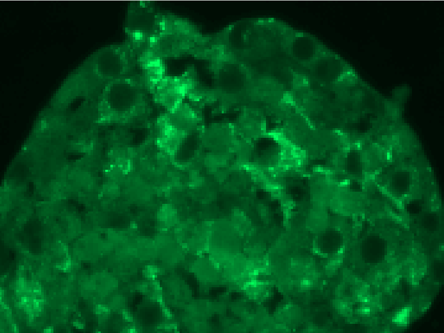 Cells are positive for albumin