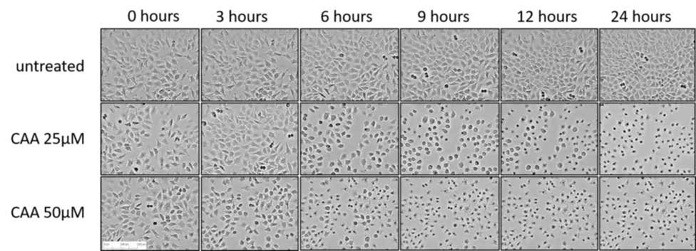 CAA Cell Morphology CAA Cell Morphology