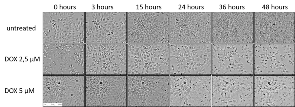 DOX Effect Morphology DOX Effect Morphology