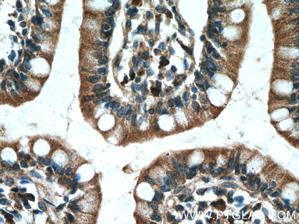 PDK1 Polyclonal antibody