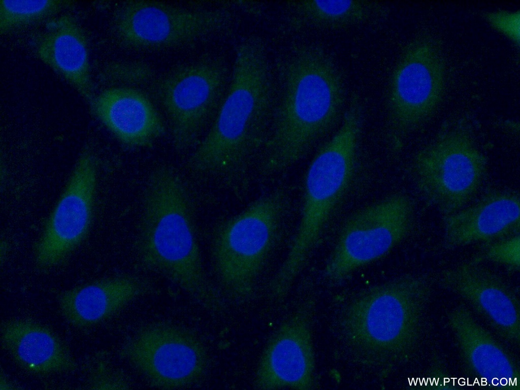 ARL4C Polyclonal antibody