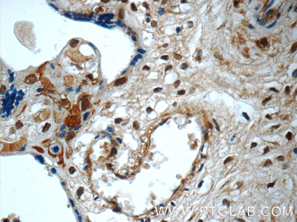 SMAD4 Polyclonal antibody