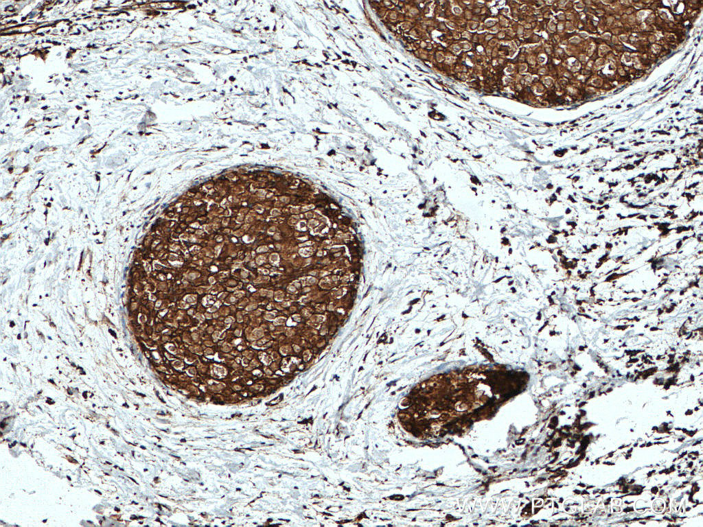 GDI1 Polyclonal antibody