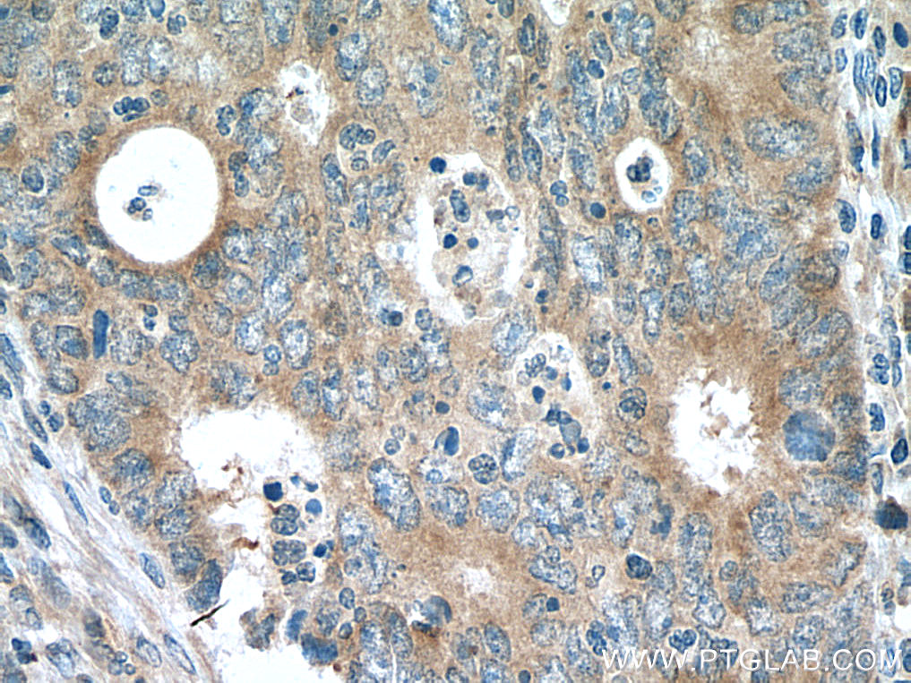 NME6 Polyclonal antibody