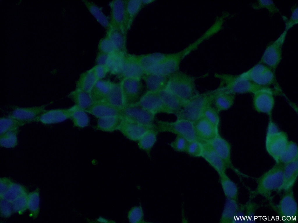 TES Polyclonal antibody