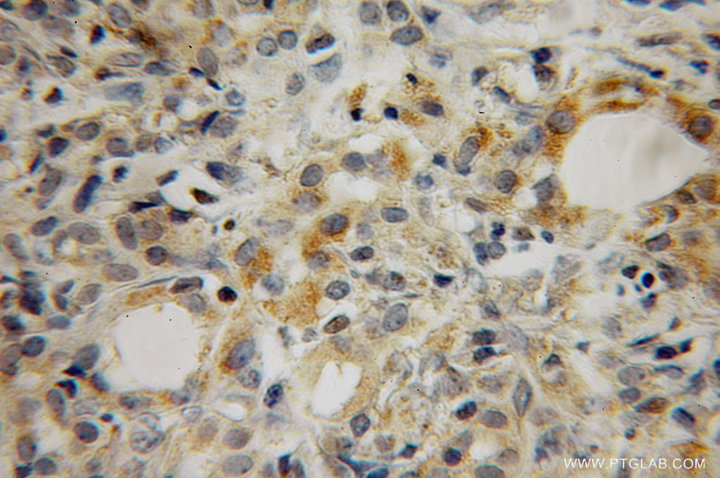 MEA1 Polyclonal antibody