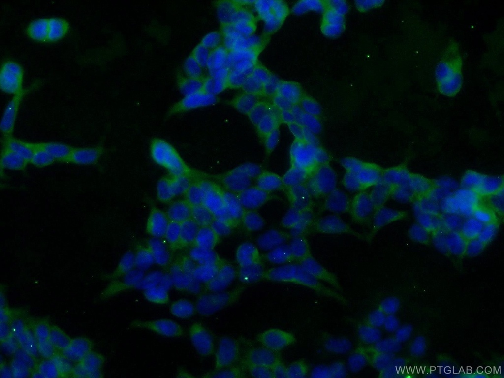 SOD1 Polyclonal antibody