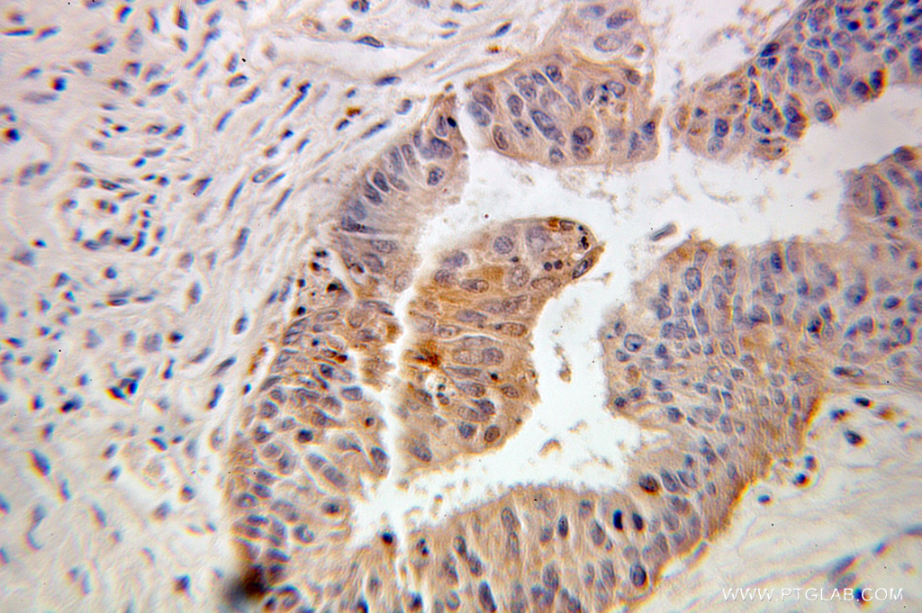 FKBP1A Polyclonal antibody