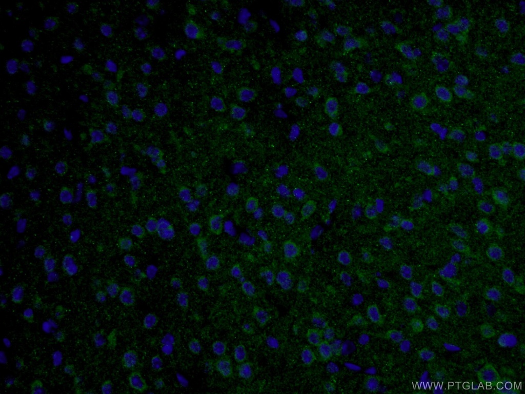 TAU Polyclonal antibody