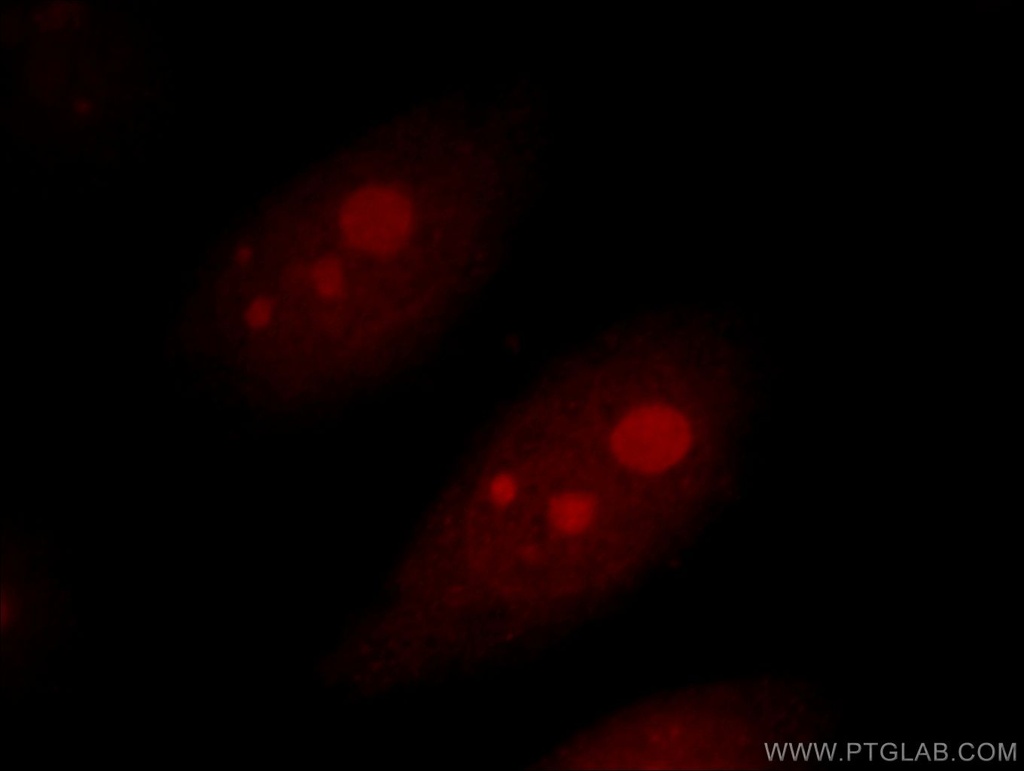 AATF Polyclonal antibody