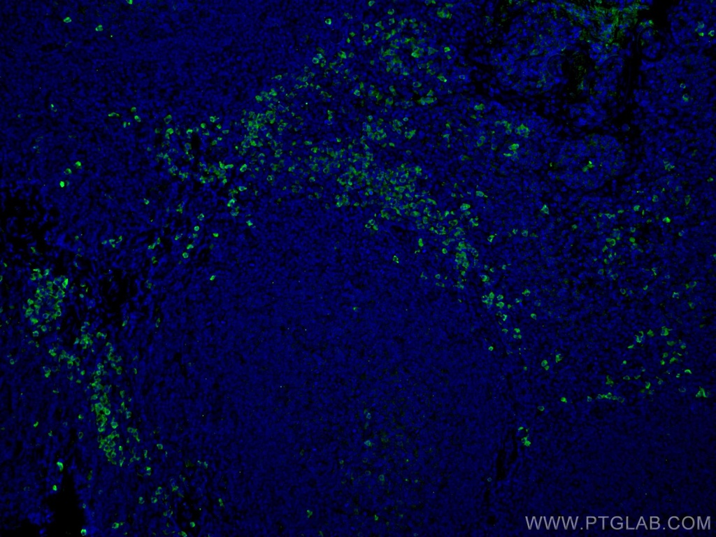 Human IgG Polyclonal antibody