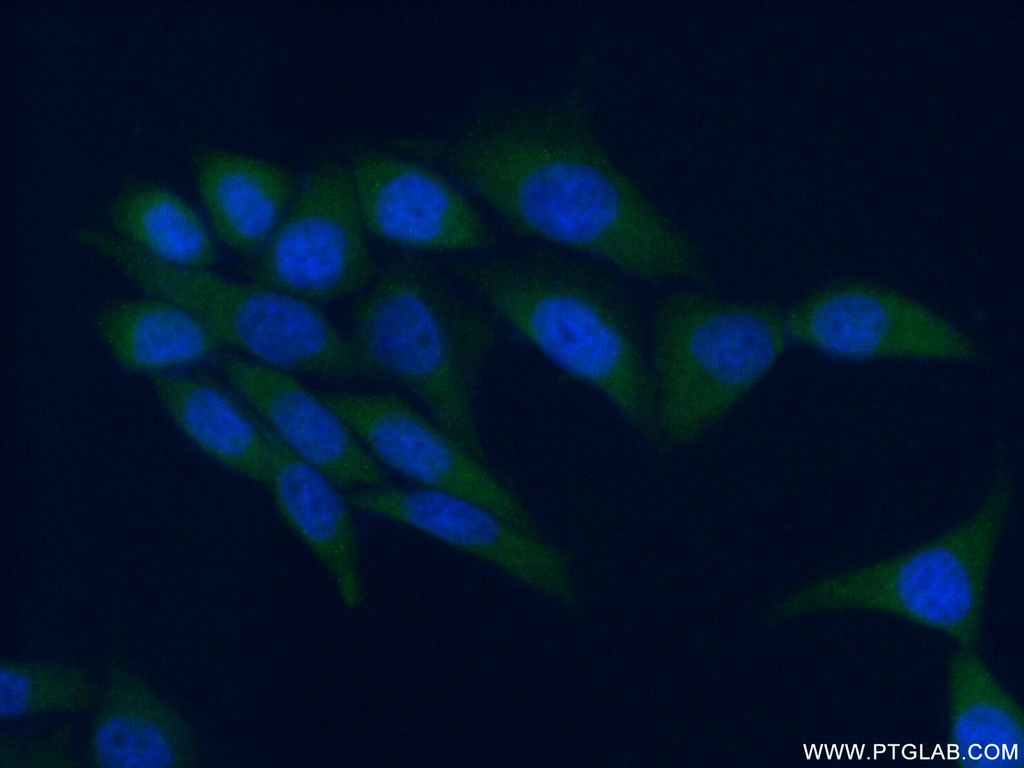 AMPK Gamma 1 Polyclonal antibody