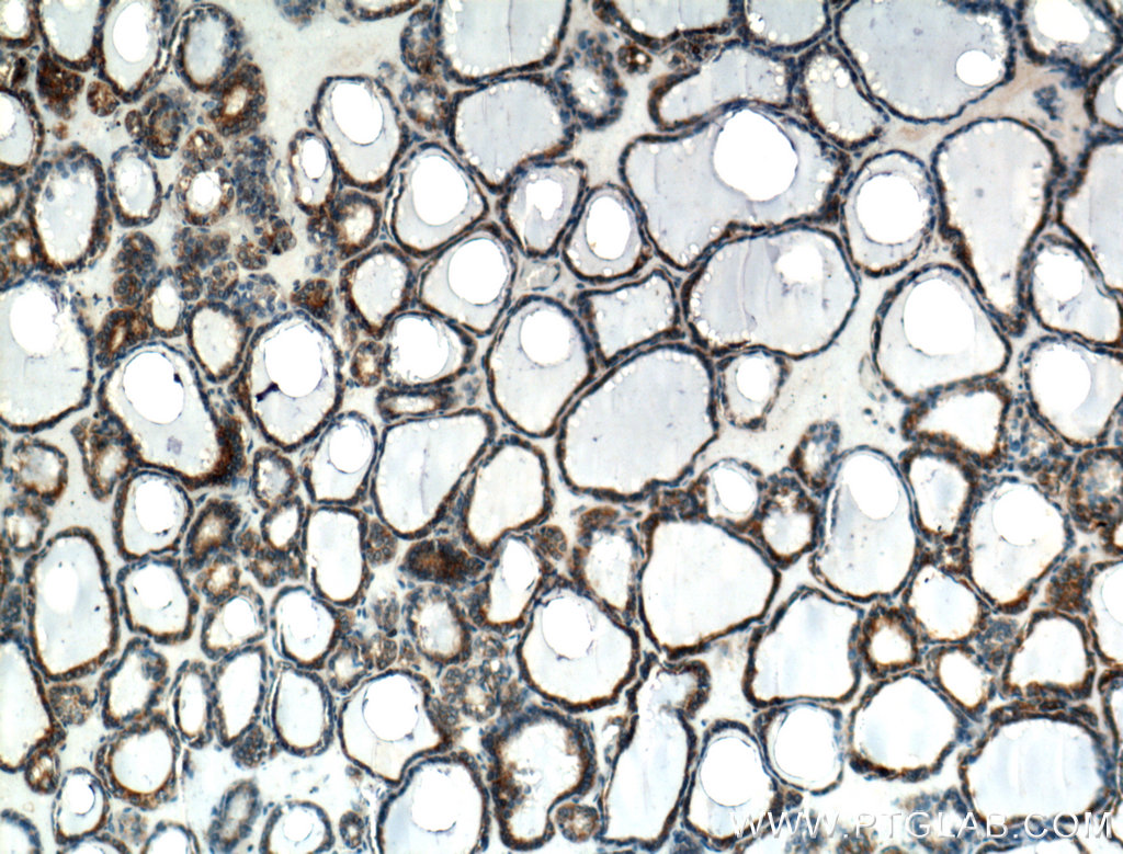 calreticulin Polyclonal antibody