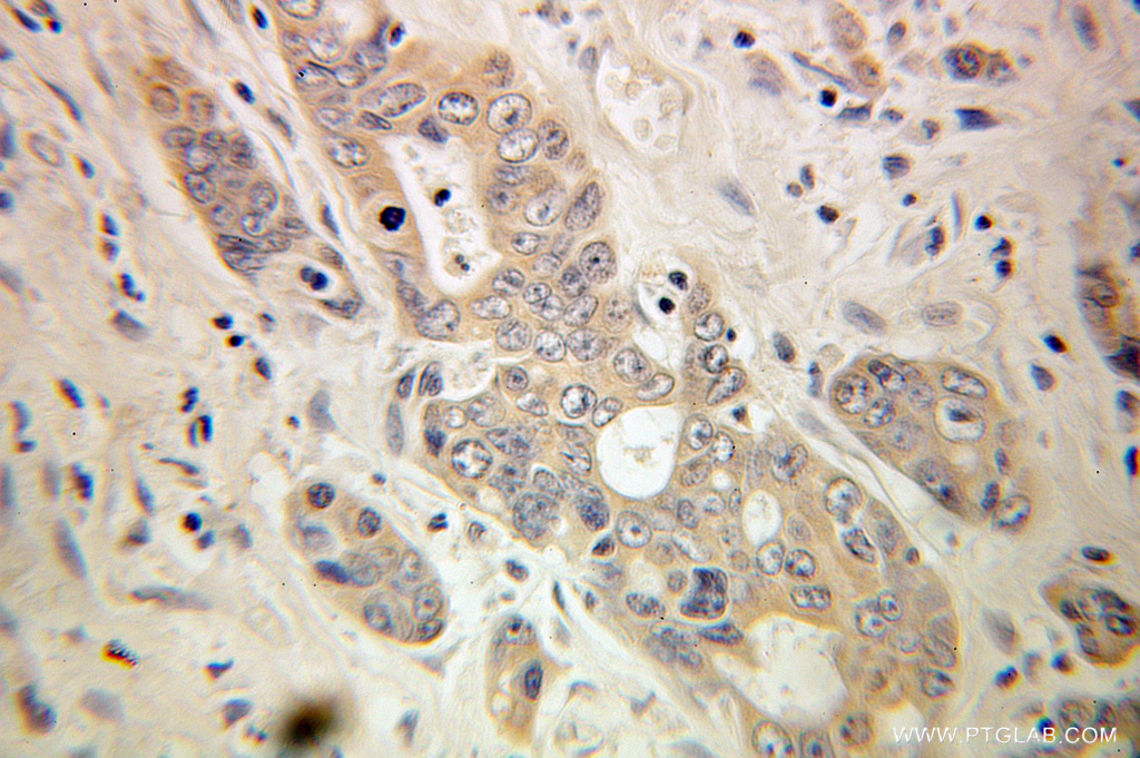 Torsin A Polyclonal antibody