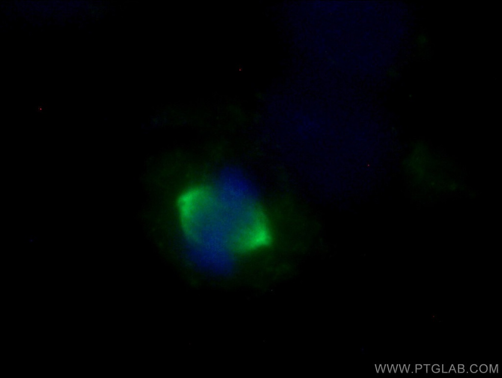 Aurora A Polyclonal antibody