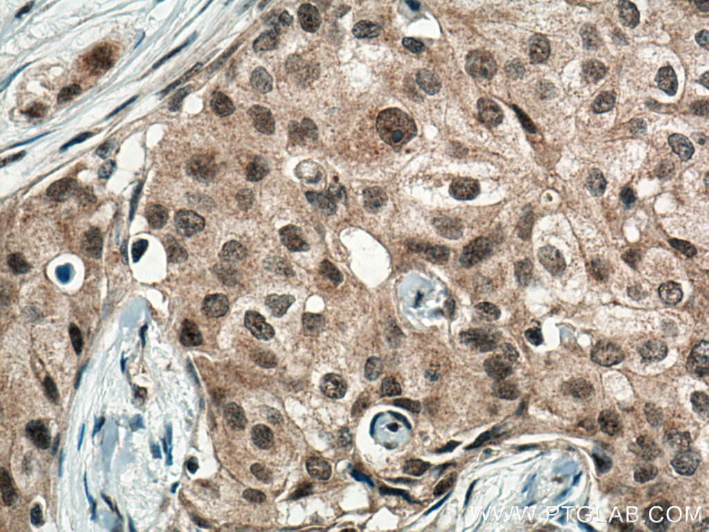 WBP11 Polyclonal antibody