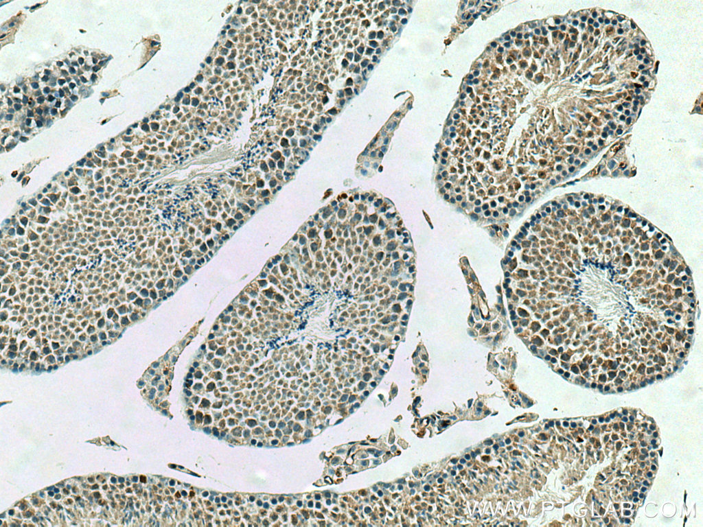 PPP2R4 Polyclonal antibody