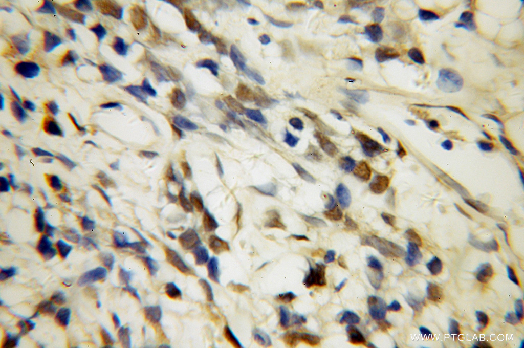 U2AF35 Polyclonal antibody