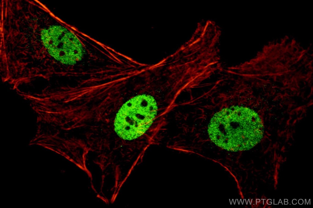 PAX8 Polyclonal antibody