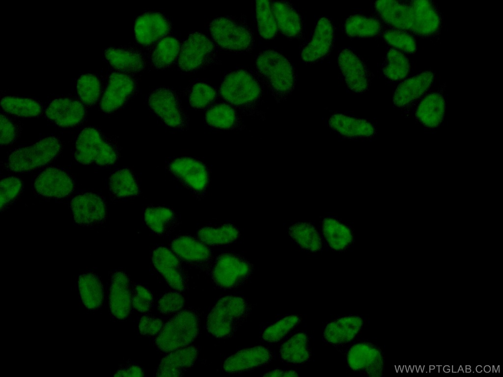 MAD2L1 Polyclonal antibody
