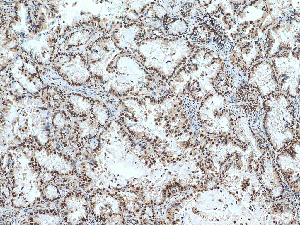 ACTL6A Polyclonal antibody