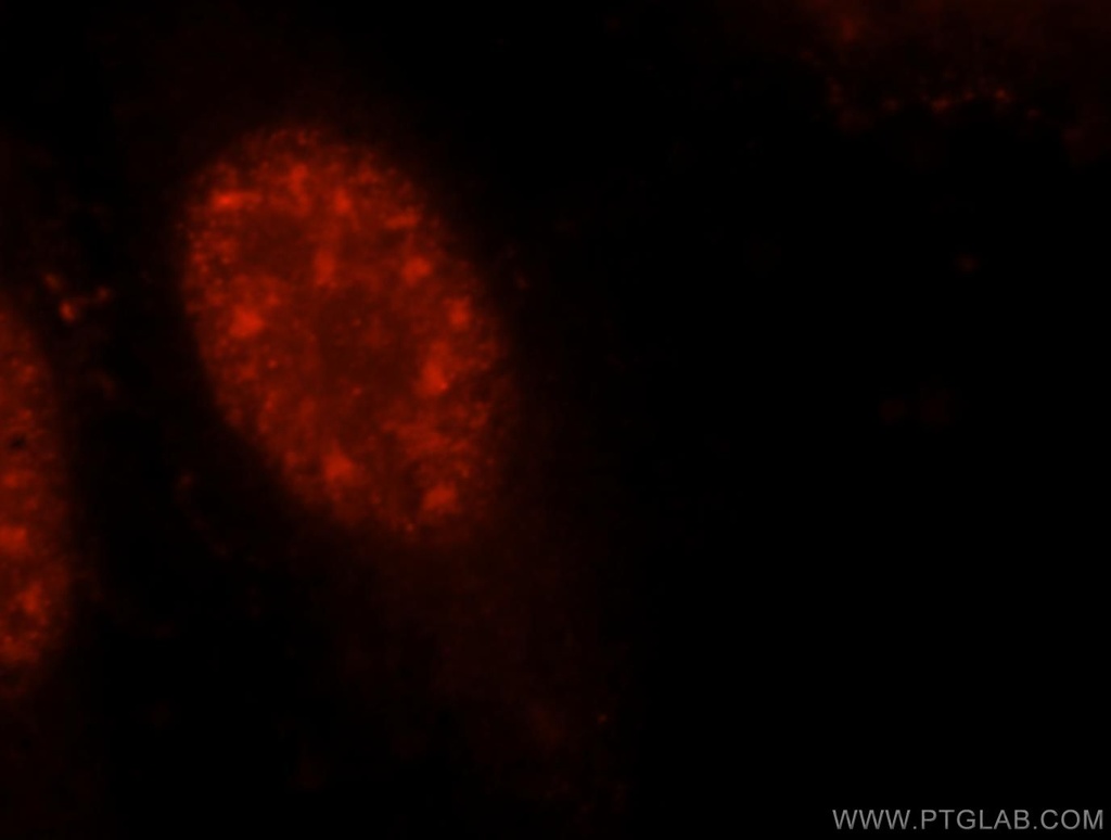 UBE3A Polyclonal antibody
