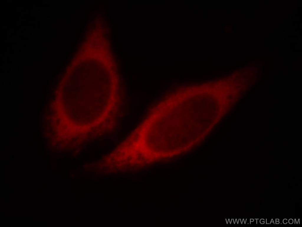 HBS1L Polyclonal antibody