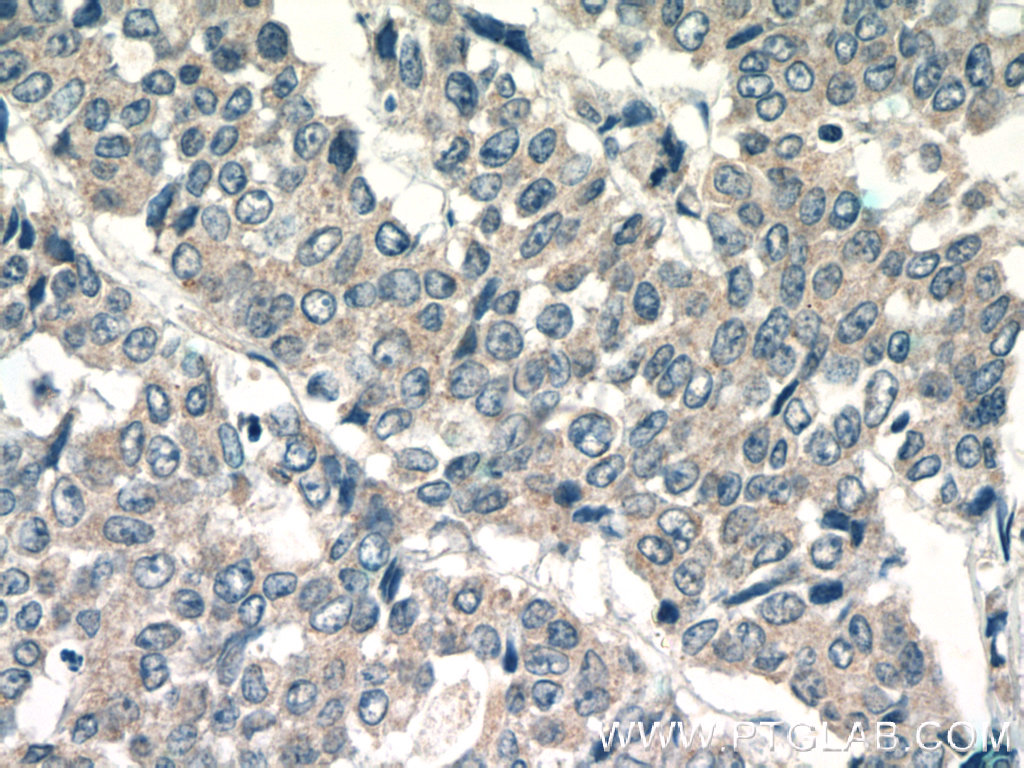 LPO Polyclonal antibody