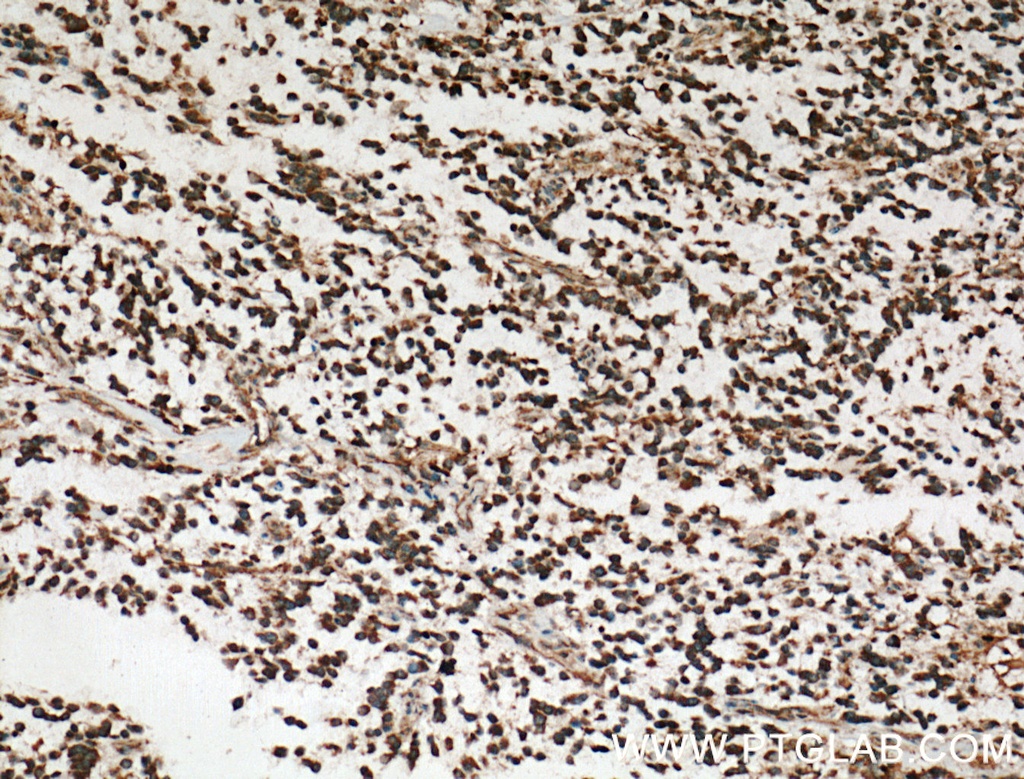 RAP1GDS1 Polyclonal antibody