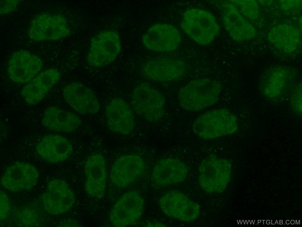 NEK6 Polyclonal antibody