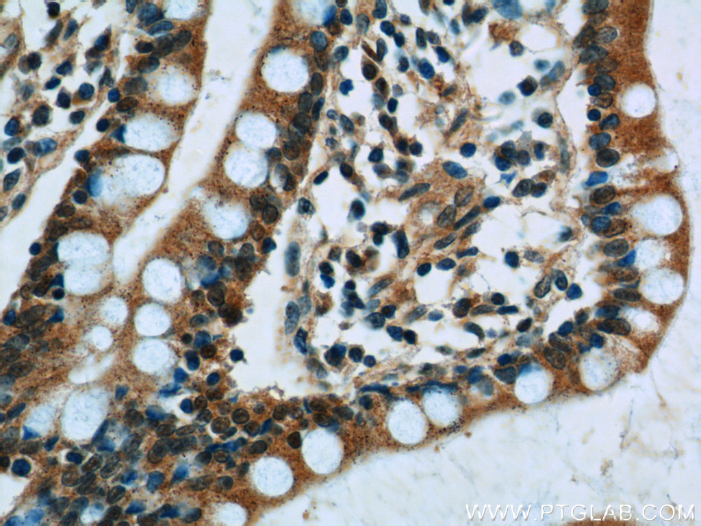 SNRPD3 Polyclonal antibody