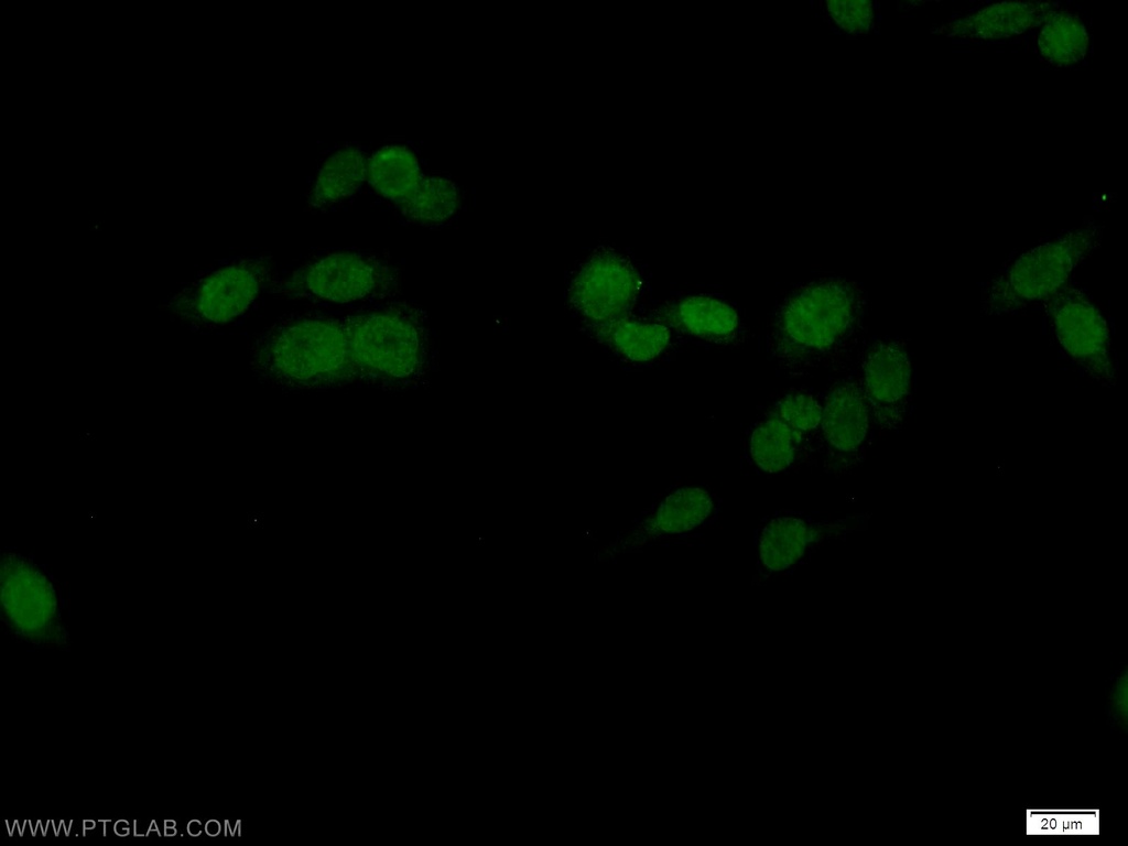 OCT1 Polyclonal antibody