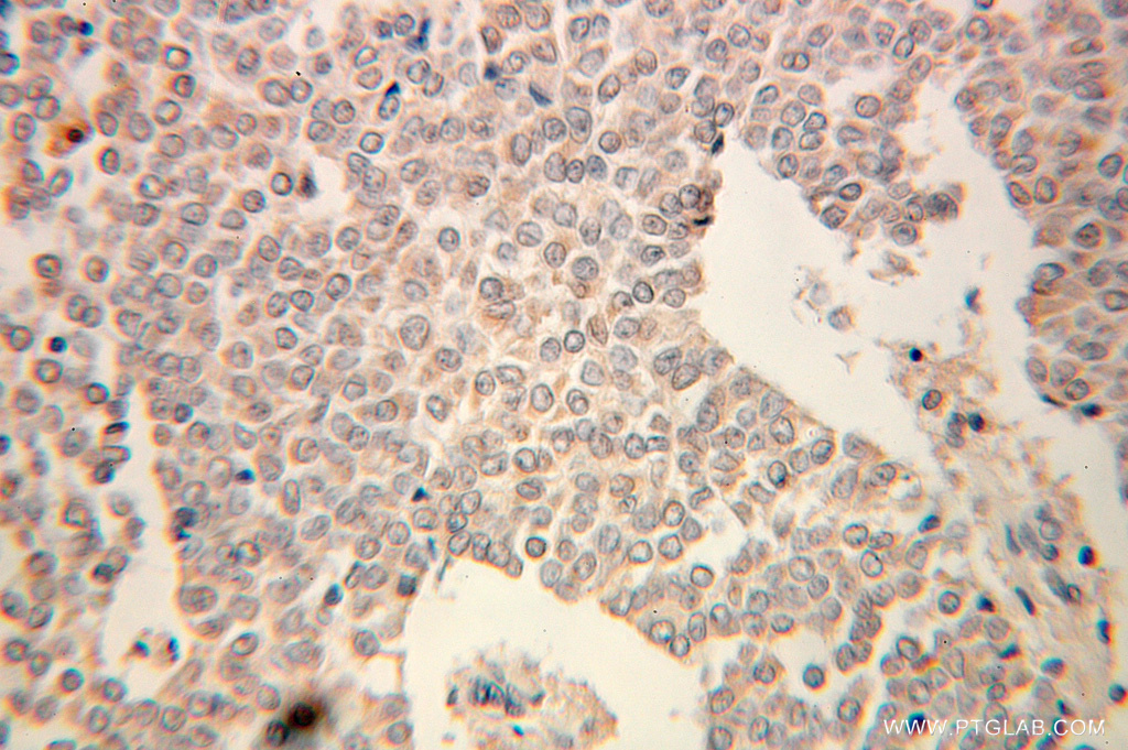 UGP2 Polyclonal antibody