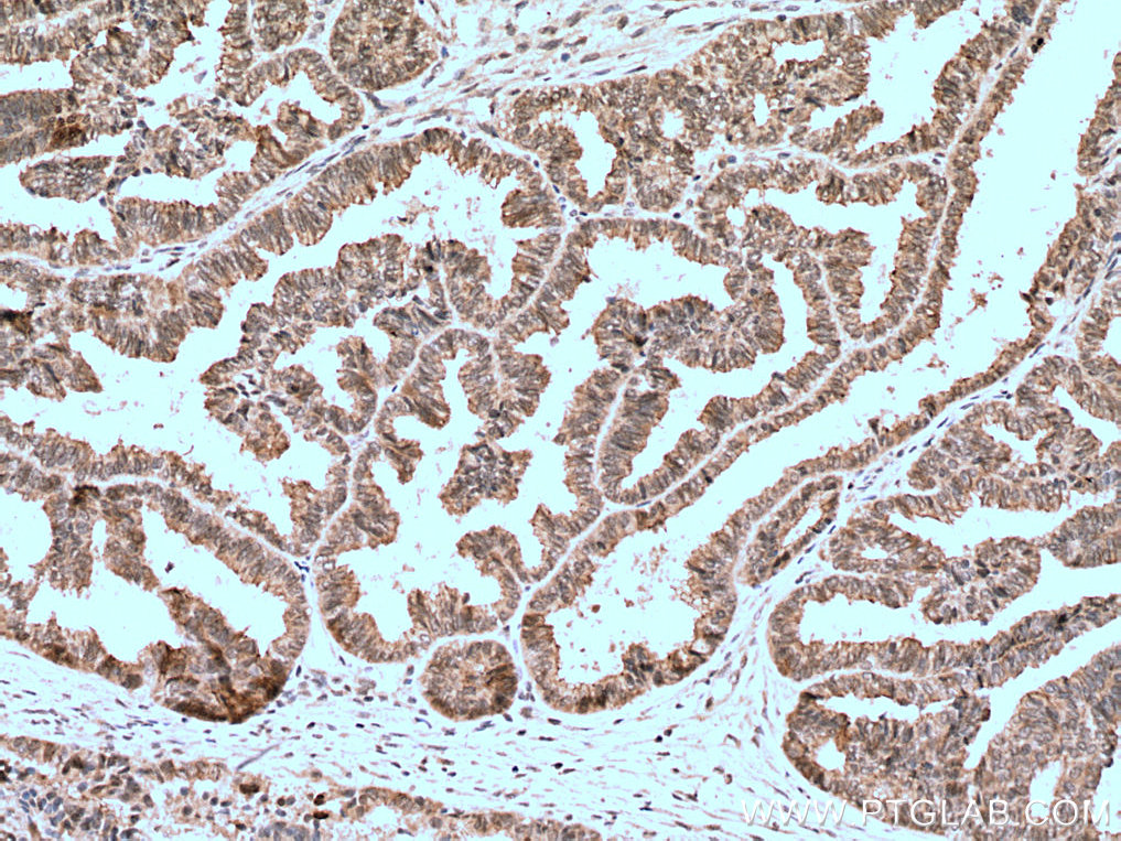 BAP1 Polyclonal antibody