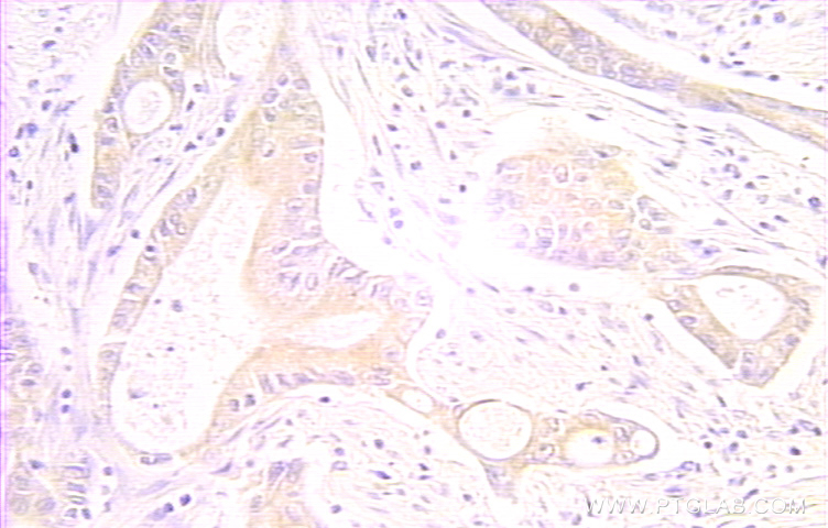 RAIDD Polyclonal antibody