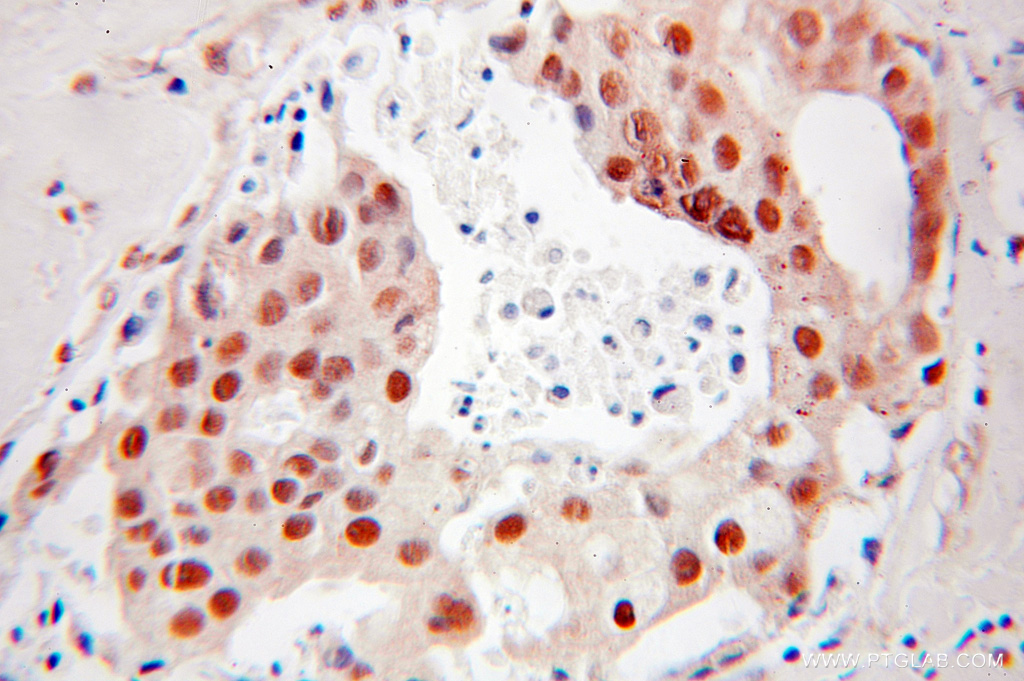 DR1 Polyclonal antibody