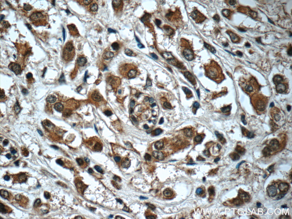 Syntenin 2 Polyclonal antibody