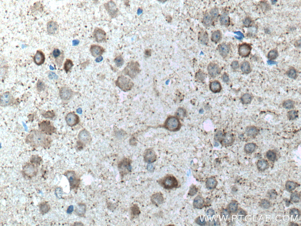 GAD1 Polyclonal antibody