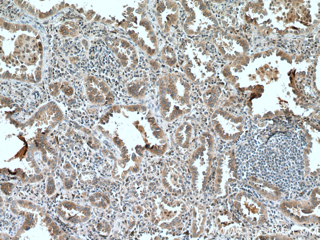SLC25A3 Polyclonal antibody