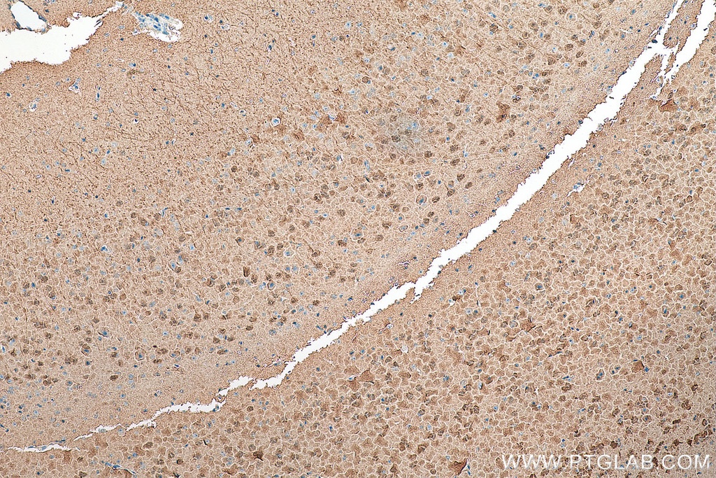 Neurogranin Polyclonal antibody