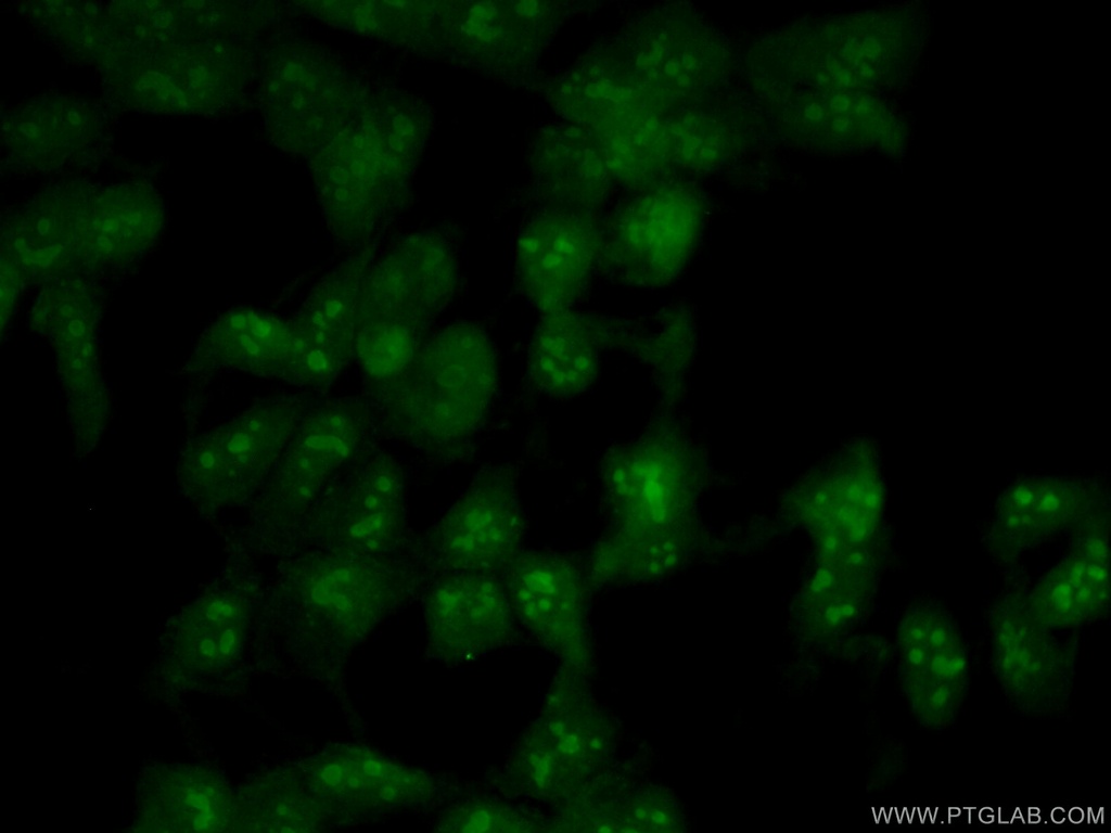 NOP2 Polyclonal antibody
