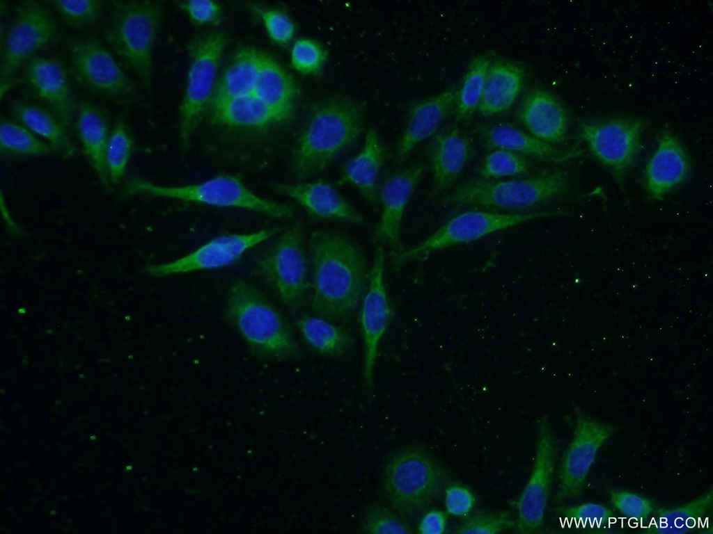 GADD34 Polyclonal antibody