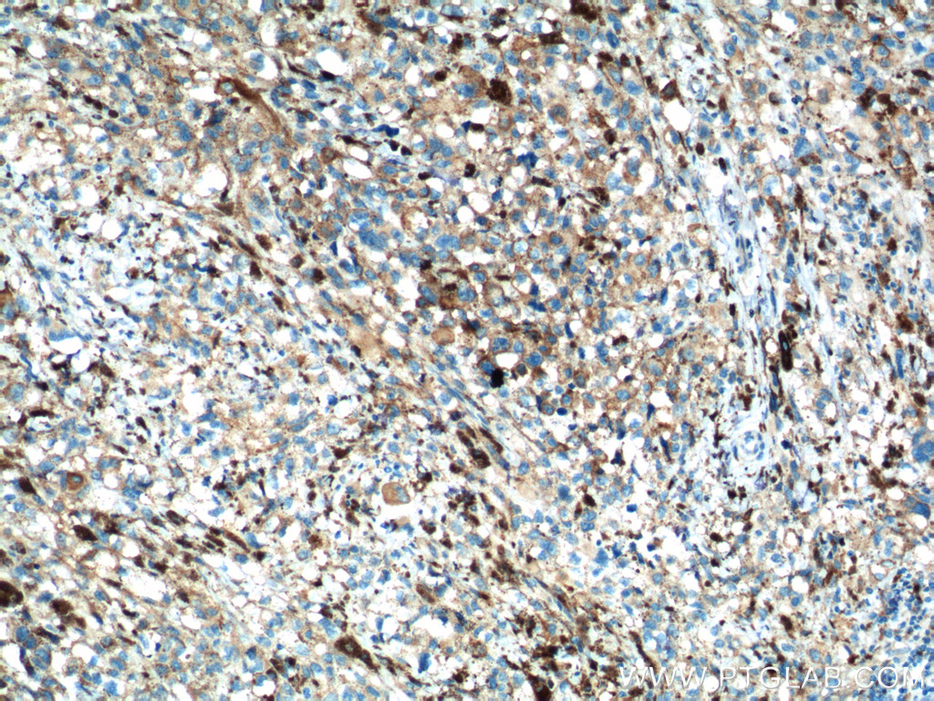 SLC45A2 Polyclonal antibody