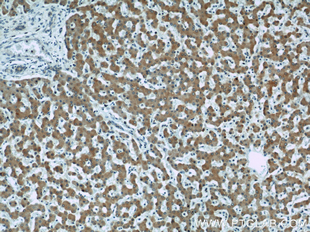 Seladin 1 Polyclonal antibody