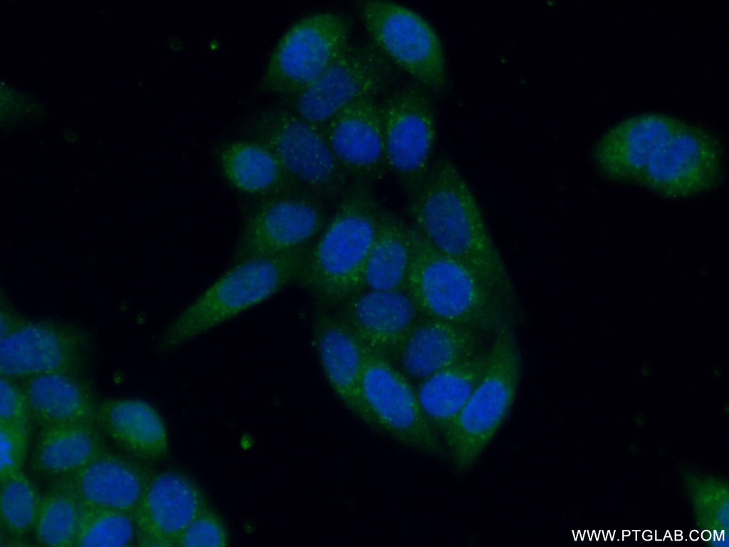 PTPN23 Polyclonal antibody