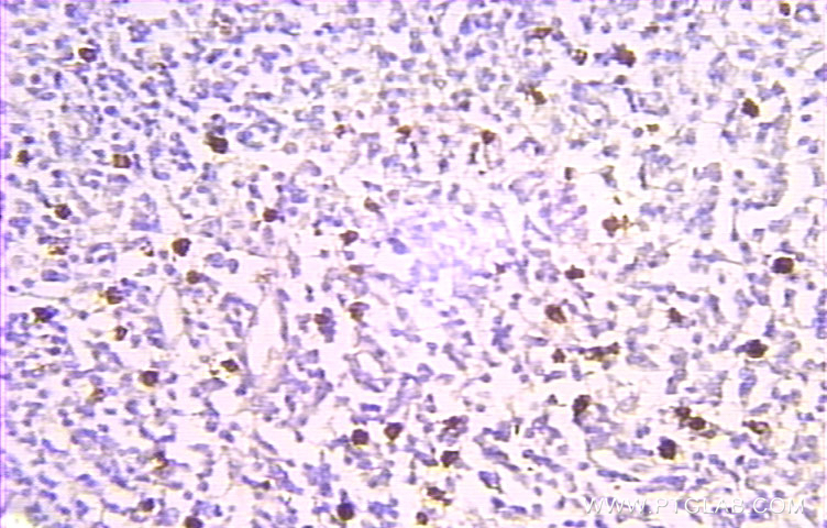 Prothymosin Alpha Polyclonal antibody