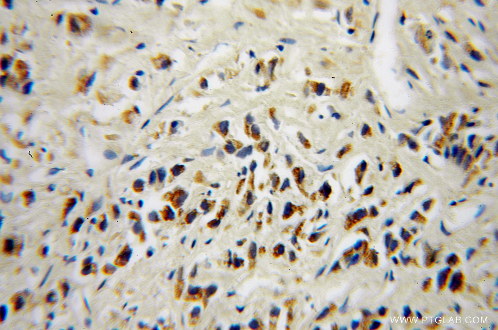 DOK4 Polyclonal antibody