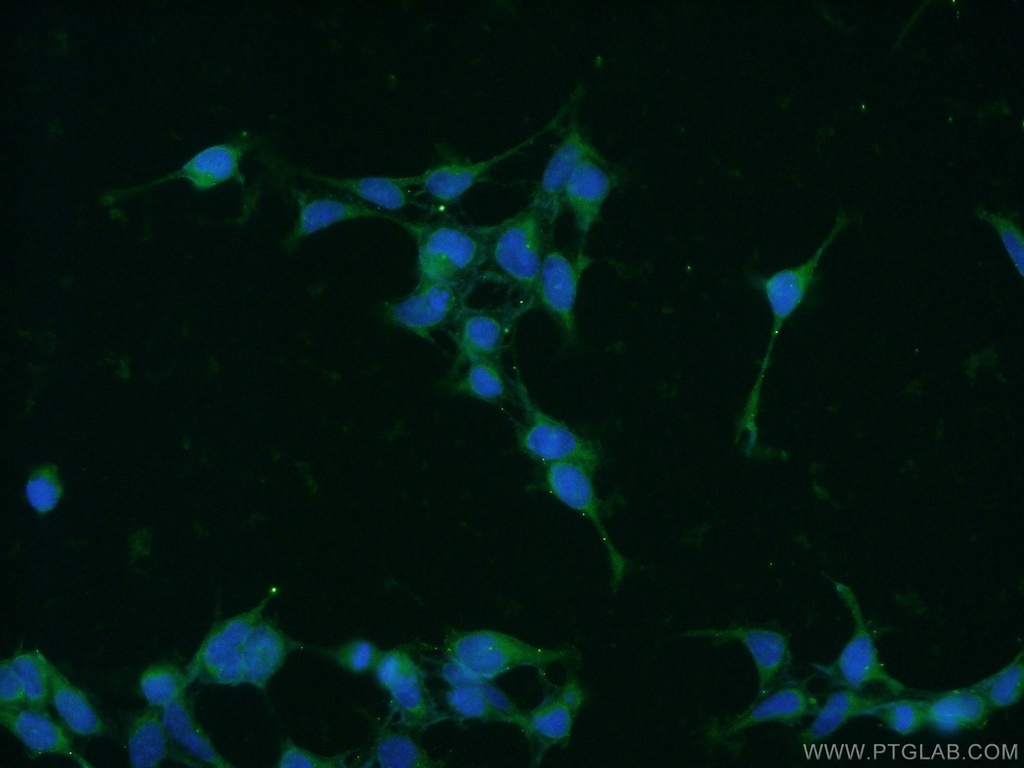 PIN1 Polyclonal antibody