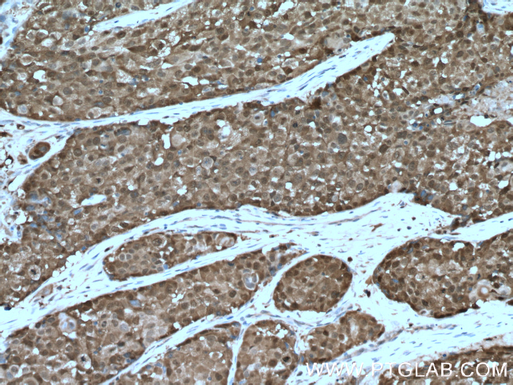 ASC/TMS1 Polyclonal antibody